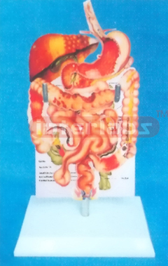 DESK-TYPE, HUMAN COMMON DISEASES OF THE DIGESTIVE SYSTEM MODEL WITH DESCRIPTION PLATE